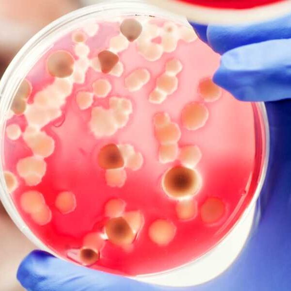 Diagnostic dilemma: Scientist contracts plague from bacteria thought to be ‘non-infectious’