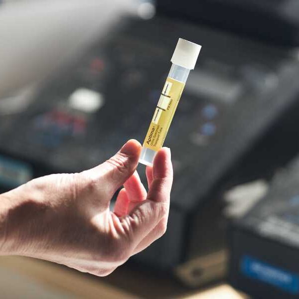 Scientists Turn Urine Into Material Suitable for Medical Implants