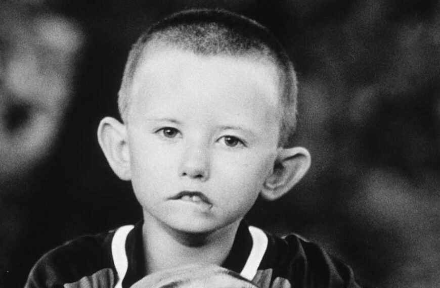 Moebius syndrome: a rare disorder that prevents people from smiling