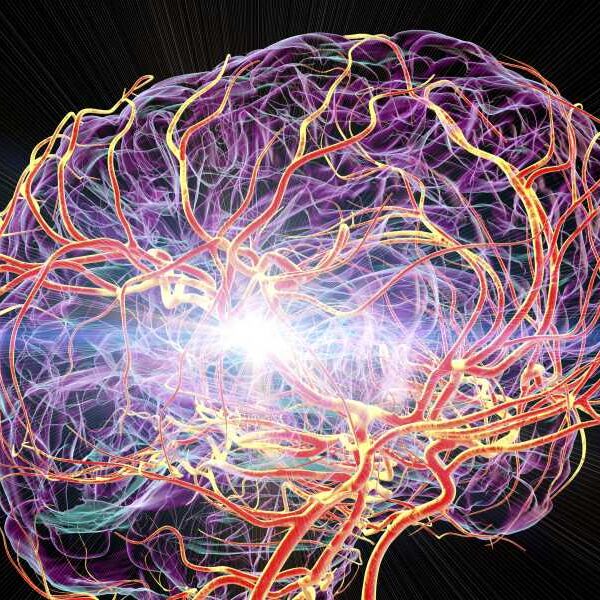 Mysterious migraines after heart surgery may finally be explained