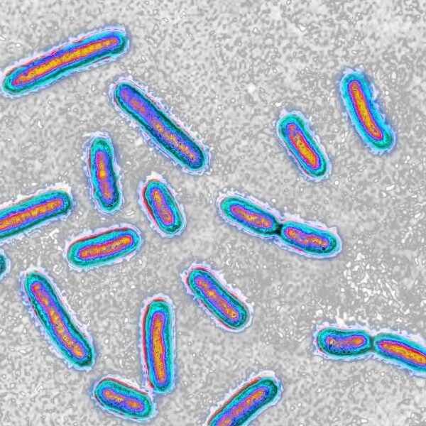 Hospital superbug can feed on medical plastic, first-of-its-kind study finds