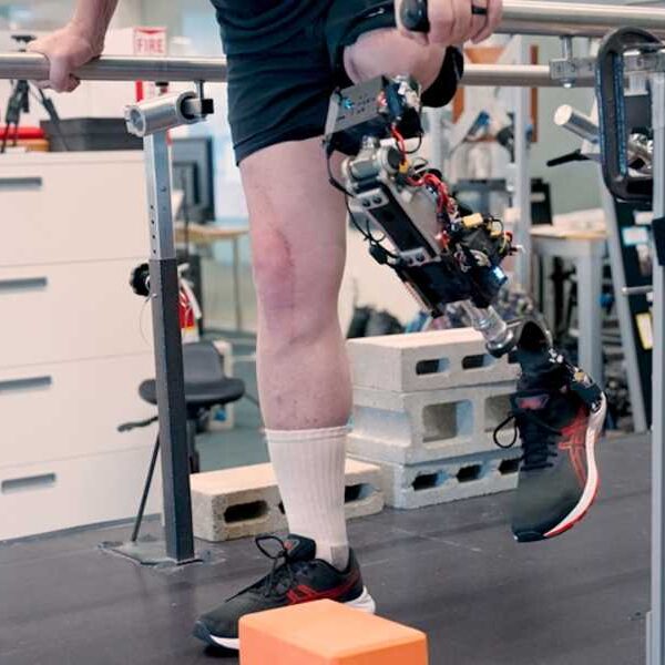The new bionic knee connects directly to muscles and bones to provide…