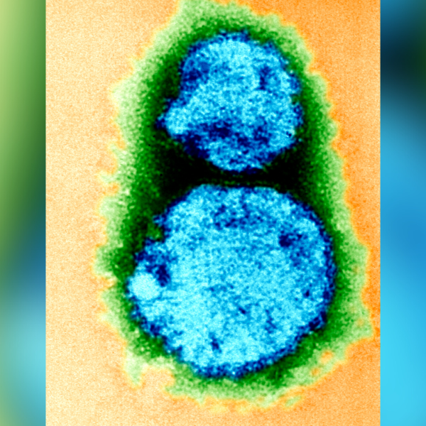 What is hantavirus? A rare but deadly respiratory disease spread by rodents.