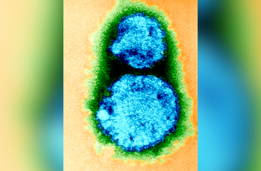 What is hantavirus? A rare but deadly respiratory disease spread by rodents.