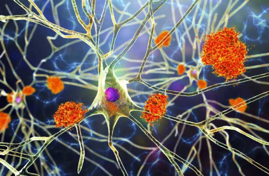 There’s a new blood test for Alzheimer’s disease. Here’s everything you need&hellip;