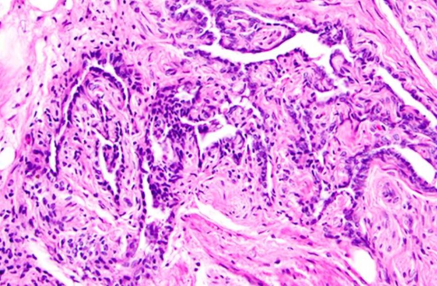 A ‘useless’ female organ discovered more than a century ago may actually&hellip;