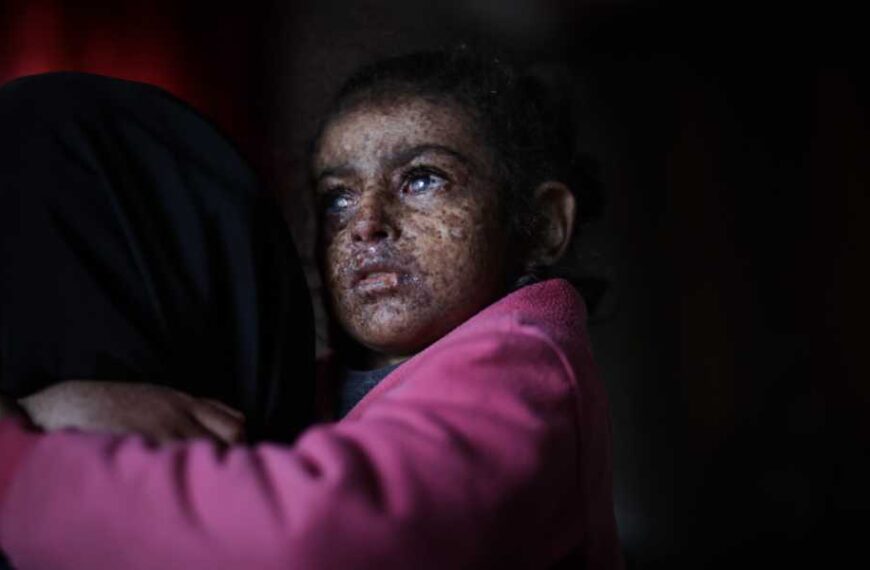 What is xeroderma pigmentosum? A rare genetic disorder that causes people to…