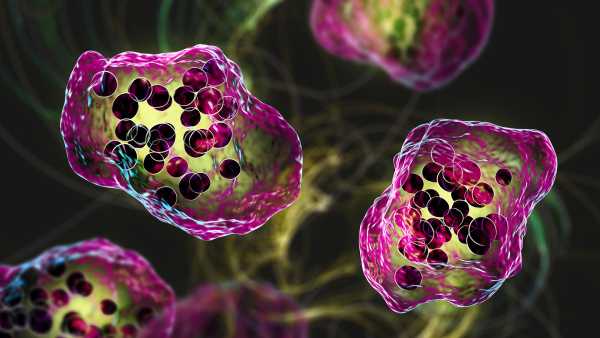 South Carolina’s measles surge is the biggest since US eradication.