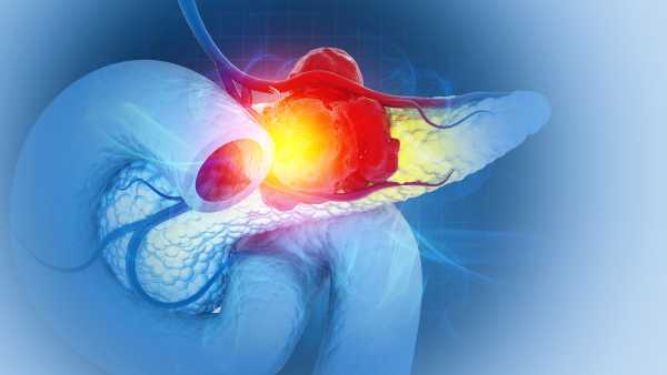 Mouse Trial: Pancreatic Cancer Halted by Novel Three-Drug Therapy