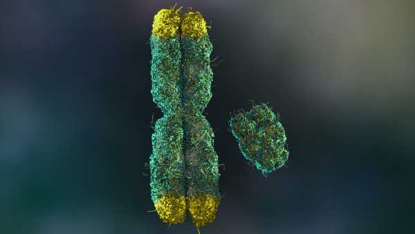 Aging Guys and Y Chromosome Loss: A Shorter Lifespan?