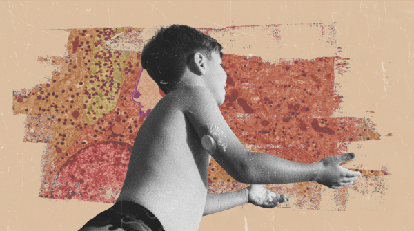 Un nuevo tratamiento a la vista: ¿Estamos finalmente cerca de&hellip;