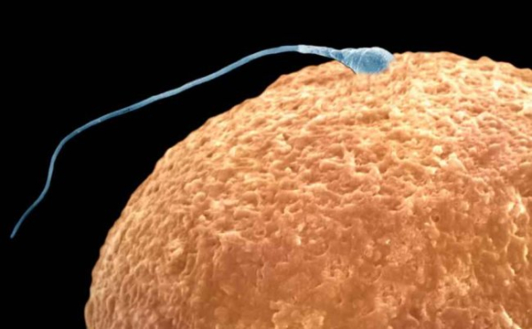 A Brilliant Way Your Body Kills Bad Sperm – You Didn’t Know&hellip;