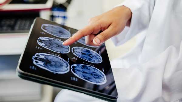 Drug-induced ‘brain freeze’ kan helpen het brein te beschermen na een beroerte,…